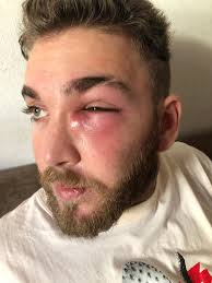 Jonathan Shelby ©️ (@_massuda_)