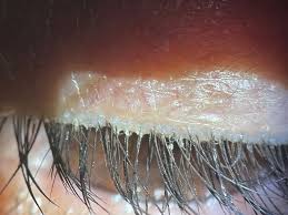 Image result for Blepharis buchneri