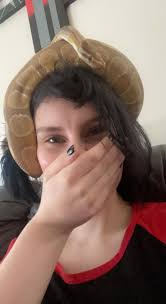 stand up down challenge failure and bruise