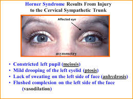 Cognitive disorders are commonly coincident. Introduction To Cranial Nerve Summary Regions Supplied By Sensory Branches Muscles Supplied By Motor Branches Exit From Cranial Cavity And Pathway In Head Ppt Download