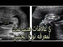 5 علامات هتساعدك علي معرفه نوع الجنين من الأسابيع الأولى في الحمل youtube