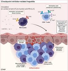 Activation and transcriptional profile of monocytes and CD8+ T cells are  altered in checkpoint inhibitor-related hepatitis