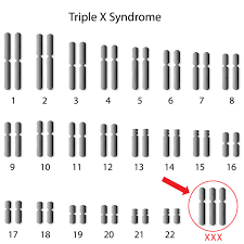 Triple X Syndrome Genetics Home Reference Nih
