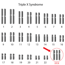 triple x syndrome genetics home reference nih