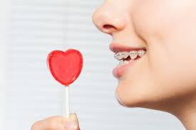 Orthodontic Appreciation Week Is Coming Soon To Wake Orthodontics Orthodontics Dental Advertising Braces