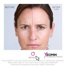 Our lovely Nurse Practitioner Sanaz performing #microneedling and #IPL  treatments