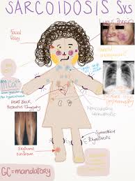 My Notes For Usmle Rahul S Noteblog Notes On Bloom S Syndrome