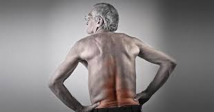 Spondylose Wirbelsaulen Verschleiss Alles Wichtige Dazu Liebscher Bracht