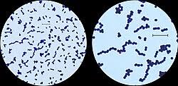 Image result for Group B Streptococcus