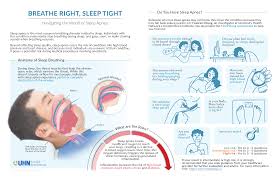 Image result for STOP-Bang Questionnaire