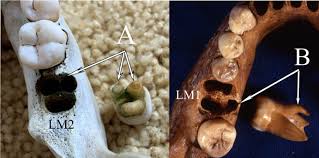 We did not find results for: A Study Refutes The Similarities Between The Teeth Of Denisovans And Modern Asians