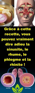Grace A Cette Recette Vous Pouvez Vraiment Dire Adieu La Sinusite Le Rhume Le Phlegme Et La Rhinite Sports Healthy Health And Nutrition Sinusitis