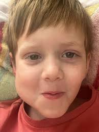 I thought my little boy, 7, had a wobbly tooth until his cheek swelled up  like a tennis ball