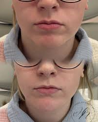 Haley Nix, NP-C (@injectionsbyhaley_np) • Instagram photos and videos