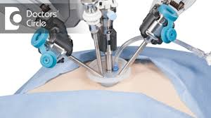 Or much more chance of having a miscarriage. How Long After A Gynaec Laparoscopy Can You Get Pregnant Dr Shefali Tyagi Youtube