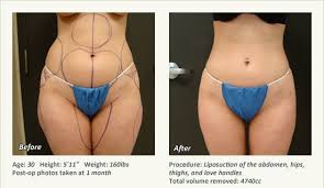 Pin On Cosmetic Surgery