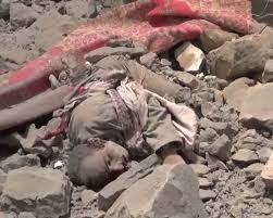 Image result for ‫جرائم العدوان على اليمن‬‎