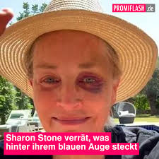 Sharon Stone verrät, was hinter ihrem blauen Auge steckt