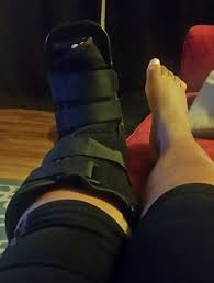 Turf toe is one of the more common injuries treated by sports medicine professionals. Turf Toe A Therapist S Personal Experience With Injury