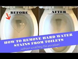 We did not find results for: How To Remove Hard Water Stains From Toilets The Forked Spoon