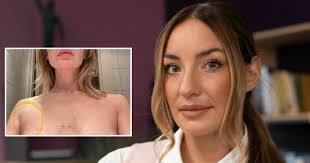 Opplevde å ikke bli trodd av kreftlegen: