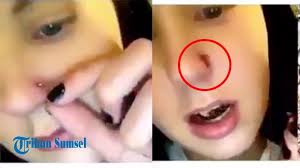 Ga sakit krn ga kena telinga di d'paris, harga tindik kuping di d'paris, harga tindik hidung di d'paris 2019, harga tindik d'paris 2019, harga tindik d'paris, tindik telinga. Pasang Tindik Di Hidung Bukannya Keren Gadis Cantik Ini Malah Alami Kejadian Mengerikan Halaman All Tribun Sumsel