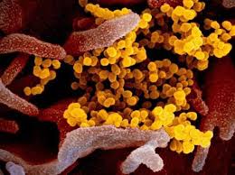 Virus corona ini adalah keluarga besar virus yang dapat menyebabkan penyakit pernapasan, simak penyebab, gejala hingga cara. Ciri Ciri Virus Lengkap Dengan Pengertiannya