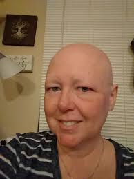 This is me. I am now 69 years old and I am currently almost 3 years cancer  free. When I was diagnosed 3 years ago