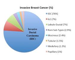 invasive ductal breast cancer and other types moose and doc