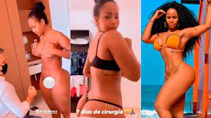 Cenapop · Vice no Miss Bumbum, Juh Campos mostra antes e depois de  lipoescultura