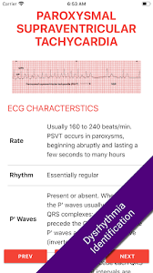 Download Ecg Flashcards 2 Lite Free Reference Ekg App Free For Android Ecg Flashcards 2 Lite Free Reference Ekg App Apk Download Steprimo Com