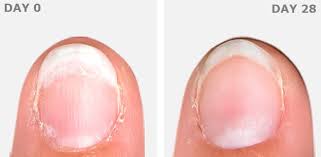 Then, an acrylic nail is placed on top. How To Repair Damaged And Split Nails Isdin S Blog