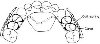 Andrea locatelli (born 16 october 1996 in alzano lombardo) is an italian motorcycle racer. References In Dental And Skeletal Changes After Intraoral Molar Distalization With Sectional Jig Assembly American Journal Of Orthodontics And Dentofacial Orthopedics