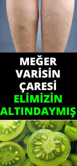 Pin On Alternatif Tip