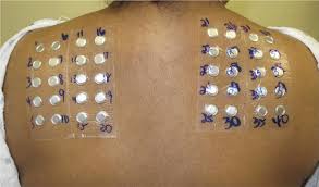 Contact Dermatitis Synopsis World Allergy Organization