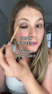 Fell Off Peloton and Blacked My Eye