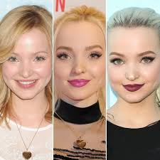 All About Dove Cameron Plastic Surgery Operations