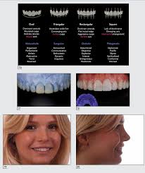 Visagism: The Art of Dental Composition