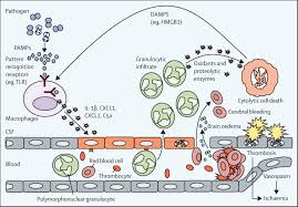 Community Acquired Bacterial Meningitis The Lancet