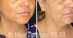 Black Friday Giveaway Win 2 Venus Laser treatments. 1.Like our page 2.Share  our post 3. Tag 4 friends May enter multiple times. Winner announcement  next Friday. Good Luck