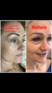 Loan Diep (@loanlashspa) • Instagram photos and videos