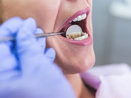 10 Home Remedies For Toothache Clove oil,orajel, take a piece of gauze and saturate it with what ever one you choose and placeon tooth.