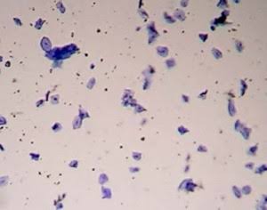 Image result for cheek cells low magnification"