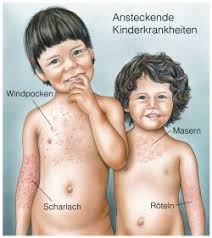 Roteln Rubella Symptome Verlauf Und Behandlung