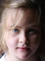 Disability and beauty: Rick Guidotti's photos challenge perceptions