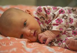 Jaundice In Newborn Babies Reasons Signs Treatment