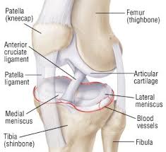 Stearns, is usually a form of arthritis. Torn Meniscus Guide Causes Symptoms And Treatment Options