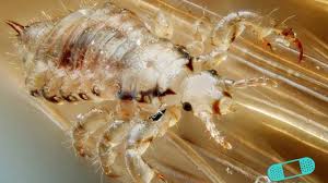 All sexual contacts of the infested person should be examined. Head Lice Infestation Online Dermatology