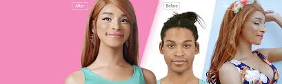 Hospital sungai buloh selangor, sungai buloh, malaysia. Plastic Surgery In Korea Id Hospital Asia Beauty Center