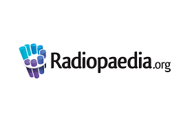 Professor Frank Gaillard Founder And Editor In Chief Of Radiopedia Org Doctorpreneurs Articles, cases, courses and more. professor frank gaillard founder and